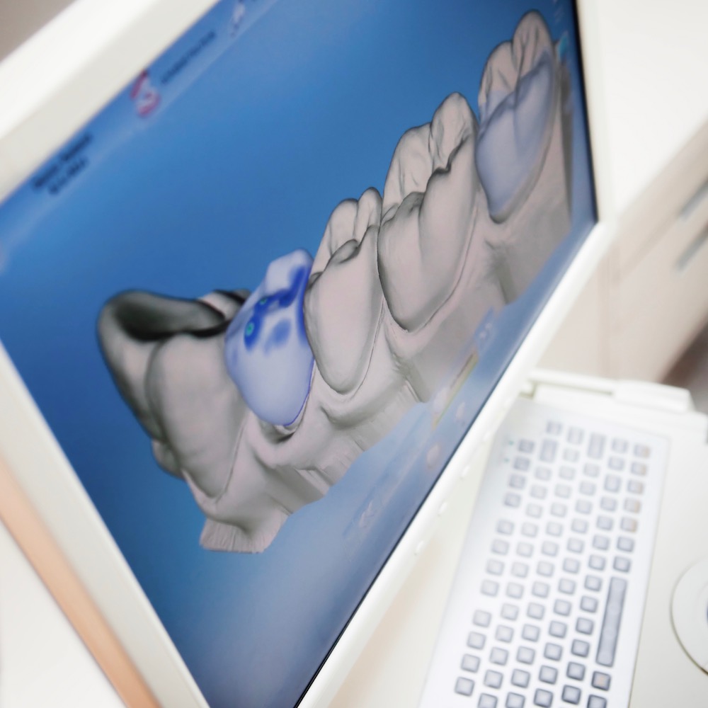 3D Darstellung Zähne